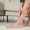 Woman assessing her legs to see if she has spider veins or varicose veins