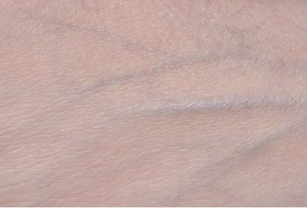 reticular veins. they are wide, straight, and greyish