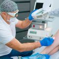 person getting laser spider vein removal